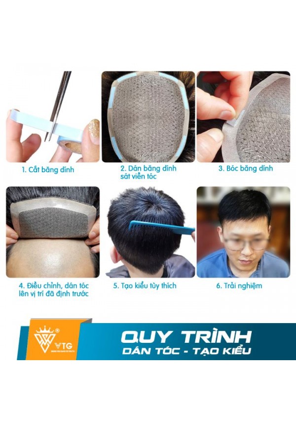 Tóc Giả Dạng Dán Che  Hói Nam Mái Simple Hair - VTG D11